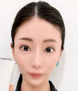 泉水 昴